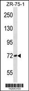 Sodium Channel Epithelial 1 Beta Subunit antibody, 60-822, ProSci, Western Blot image 