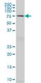 Heat Shock Protein Family A (Hsp70) Member 2 antibody, H00003306-M03, Novus Biologicals, Western Blot image 