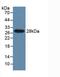 Cytochrome P450 Family 2 Subfamily E Member 1 antibody, LS-C294115, Lifespan Biosciences, Western Blot image 