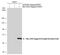 Estrogen Receptor 2 antibody, 3336, QED Bioscience, Western Blot image 