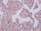Dihydrouridine Synthase 2 antibody, NBP2-16234, Novus Biologicals, Immunohistochemistry paraffin image 