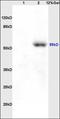 Solute Carrier Family 12 Member 3 antibody, orb67566, Biorbyt, Western Blot image 