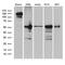 Ariadne RBR E3 Ubiquitin Protein Ligase 2 antibody, M08154, Boster Biological Technology, Western Blot image 