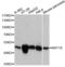Keratin 18 antibody, A1022, ABclonal Technology, Western Blot image 