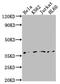 TATA-Box Binding Protein antibody, CSB-RA821481A0HU, Cusabio, Western Blot image 