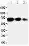 2AR antibody, PA1432, Boster Biological Technology, Western Blot image 