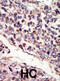 Neurotrophic Receptor Tyrosine Kinase 3 antibody, abx033618, Abbexa, Immunohistochemistry paraffin image 