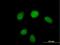HUS1 Checkpoint Clamp Component antibody, H00003364-B01P, Novus Biologicals, Immunofluorescence image 