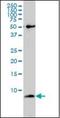 ATP Synthase F1 Subunit Epsilon antibody, orb89560, Biorbyt, Western Blot image 