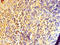 DIS3 Like 3'-5' Exoribonuclease 2 antibody, LS-C378131, Lifespan Biosciences, Immunohistochemistry paraffin image 