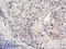 Pleckstrin Homology Domain Containing A3 antibody, NBP2-00768, Novus Biologicals, Immunohistochemistry paraffin image 
