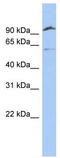 Transmembrane Serine Protease 6 antibody, TA337827, Origene, Western Blot image 