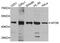 Transforming Growth Factor Beta Receptor 1 antibody, abx005607, Abbexa, Western Blot image 