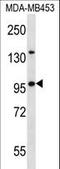 Nucleoporin 88 antibody, LS-C163079, Lifespan Biosciences, Western Blot image 