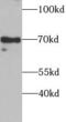 SRY-Box 5 antibody, FNab08127, FineTest, Western Blot image 