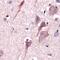 Corticotropin Releasing Hormone antibody, PA5-32364, Invitrogen Antibodies, Immunohistochemistry frozen image 