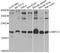 Actin Related Protein 2/3 Complex Subunit 3 antibody, A7767, ABclonal Technology, Western Blot image 