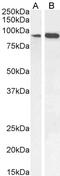 Intraflagellar Transport 88 antibody, 45-762, ProSci, Western Blot image 