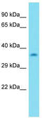 Kinetochore Localized Astrin (SPAG5) Binding Protein antibody, TA333585, Origene, Western Blot image 
