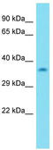 Kinetochore Localized Astrin (SPAG5) Binding Protein antibody, TA333585, Origene, Western Blot image 