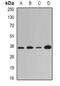 Lysyl Oxidase antibody, abx142006, Abbexa, Western Blot image 