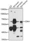 Calcium/Calmodulin Dependent Protein Kinase IV antibody, 19-573, ProSci, Western Blot image 