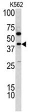 Thymine DNA Glycosylase antibody, AP17780PU-N, Origene, Western Blot image 