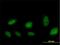 ATPase Family AAA Domain Containing 2 antibody, H00029028-B01P, Novus Biologicals, Immunofluorescence image 