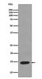 Lysozyme antibody, M01811, Boster Biological Technology, Western Blot image 