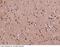 Microtubule Associated Protein RP/EB Family Member 3 antibody, 14614-T08, Sino Biological, Immunohistochemistry paraffin image 