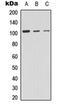 Protein Kinase D2 antibody, orb315667, Biorbyt, Western Blot image 