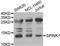 Pancreatic secretory trypsin inhibitor antibody, abx001017, Abbexa, Western Blot image 