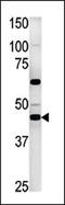 Phosphoglycerate Kinase 2 antibody, 62-702, ProSci, Western Blot image 