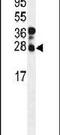 Charged Multivesicular Body Protein 4B antibody, PA5-26536, Invitrogen Antibodies, Western Blot image 