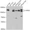 Neurotrophic Receptor Tyrosine Kinase 3 antibody, GTX54543, GeneTex, Western Blot image 