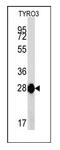 TYRO3 Protein Tyrosine Kinase antibody, AM11072PU-N, Origene, Western Blot image 