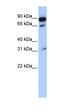 F-Box And Leucine Rich Repeat Protein 3 antibody, orb330282, Biorbyt, Western Blot image 