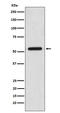 Calcium/Calmodulin Dependent Protein Kinase II Beta antibody, M03964-2, Boster Biological Technology, Western Blot image 