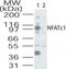 Nuclear Factor Of Activated T Cells 1 antibody, ab25916, Abcam, Western Blot image 