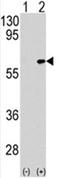 TGF-Beta Activated Kinase 1 (MAP3K7) Binding Protein 1 antibody, AP17544PU-N, Origene, Western Blot image 