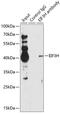 Eukaryotic Translation Initiation Factor 3 Subunit H antibody, GTX65925, GeneTex, Immunoprecipitation image 