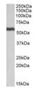 Aldehyde Dehydrogenase 5 Family Member A1 antibody, orb125066, Biorbyt, Western Blot image 