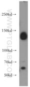 DNA Methyltransferase 3 Alpha antibody, 20954-1-AP, Proteintech Group, Western Blot image 