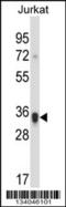 CD158 antigen-like family member H antibody, 57-341, ProSci, Western Blot image 