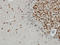 Translocated Promoter Region, Nuclear Basket Protein antibody, LS-C133494, Lifespan Biosciences, Immunohistochemistry paraffin image 