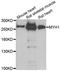 Myosin Heavy Chain 1 antibody, A6935, ABclonal Technology, Western Blot image 