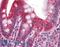 TNF Receptor Superfamily Member 25 antibody, LS-B4838, Lifespan Biosciences, Immunohistochemistry frozen image 
