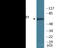 WEE1 G2 Checkpoint Kinase antibody, EKC2330, Boster Biological Technology, Western Blot image 