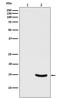 Synuclein Alpha antibody, P00215-1, Boster Biological Technology, Western Blot image 