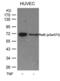 RELB Proto-Oncogene, NF-KB Subunit antibody, LS-C34202, Lifespan Biosciences, Western Blot image 